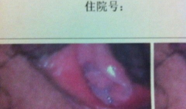 破处女膜视频,视频解析与科学解读